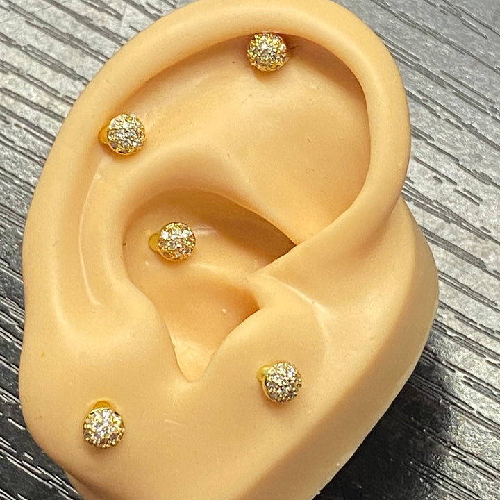 Arete Quirúrgico 🔥 Bola Fuego