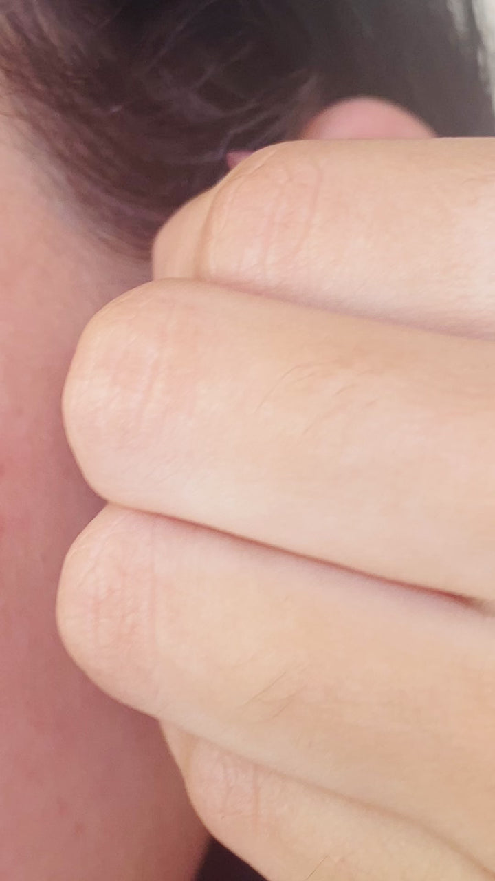 Aretes de acero