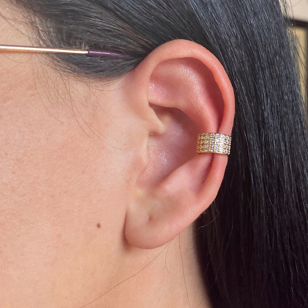 Escalador de Acero ✨ Circonias